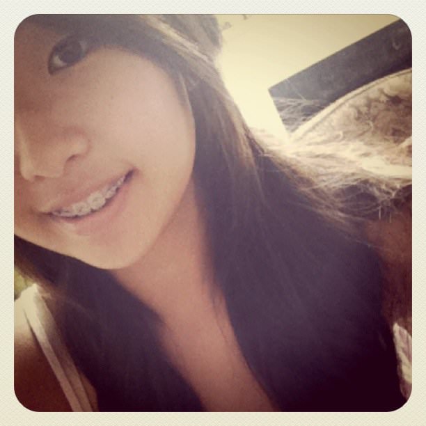 asian girl with braces.jpg